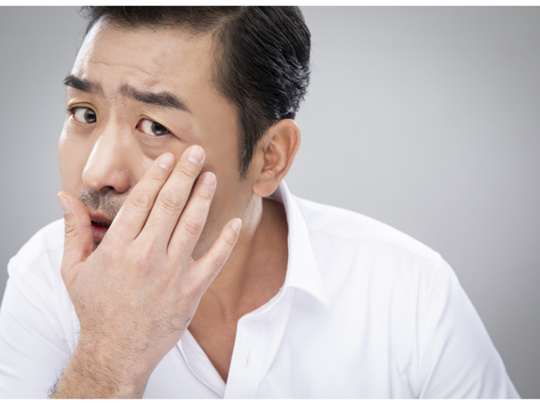 상하안검수술 인상을 바꾸기 위해 관련 이미지 10
