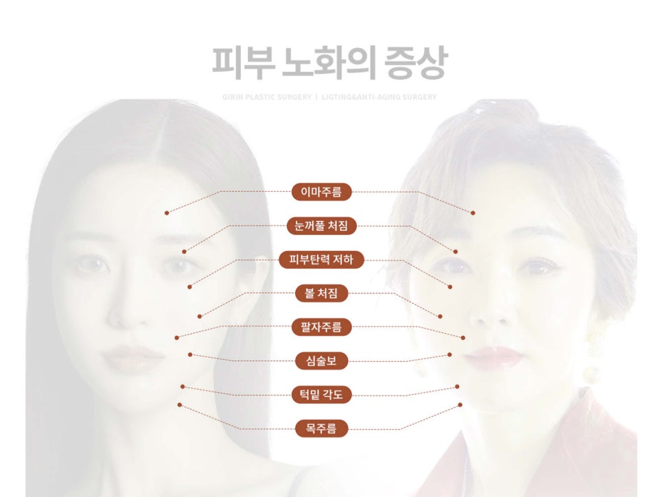 안면거상수술 효과 확실하려면 관련 이미지 4