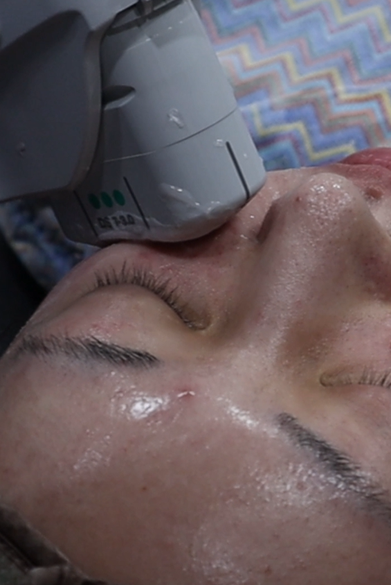 일요일에도 리프팅 가능한 이유 기린성형외과 관련 이미지 8