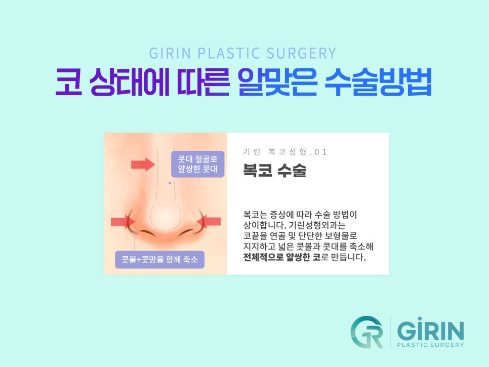 콧볼축소술 뭉툭한 코 개선을 위해 관련 이미지 10