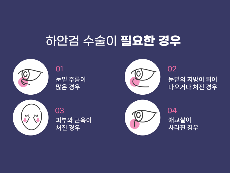 상하안검수술 인상을 바꾸기 위해 관련 이미지 12