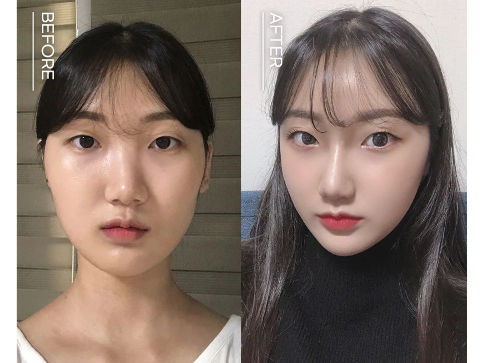 강남코성형 차이점이 있어야 관련 이미지 13