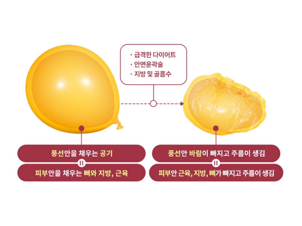 안면거상술잘하는병원 자세히 알아본다면 관련 이미지 3