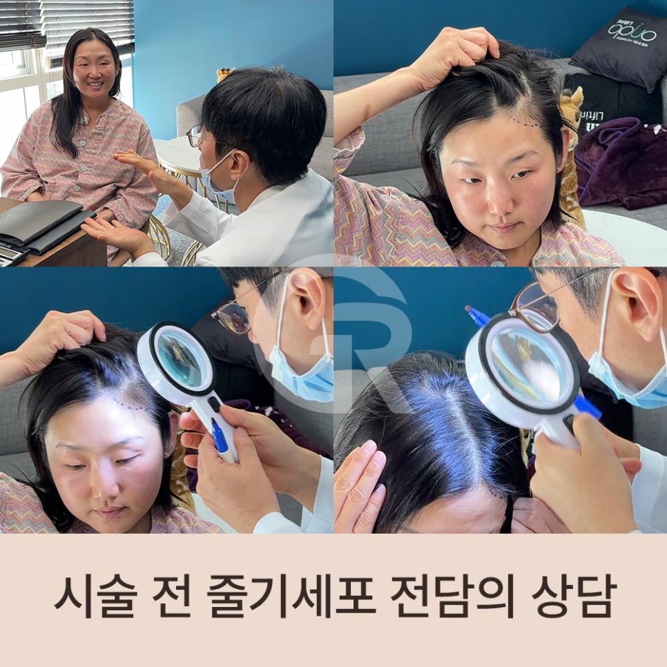 "머리숱이 없어요" 가르마 탈모 환자 줄기세포 주사 관련 이미지 2