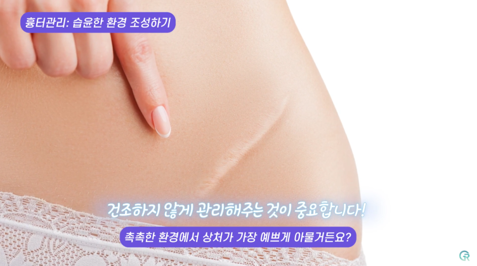 [기린성형외과] 겨울은 지방흡입의 계절_지방흡입 흉터관리 및 사후관리 관련 이미지 4