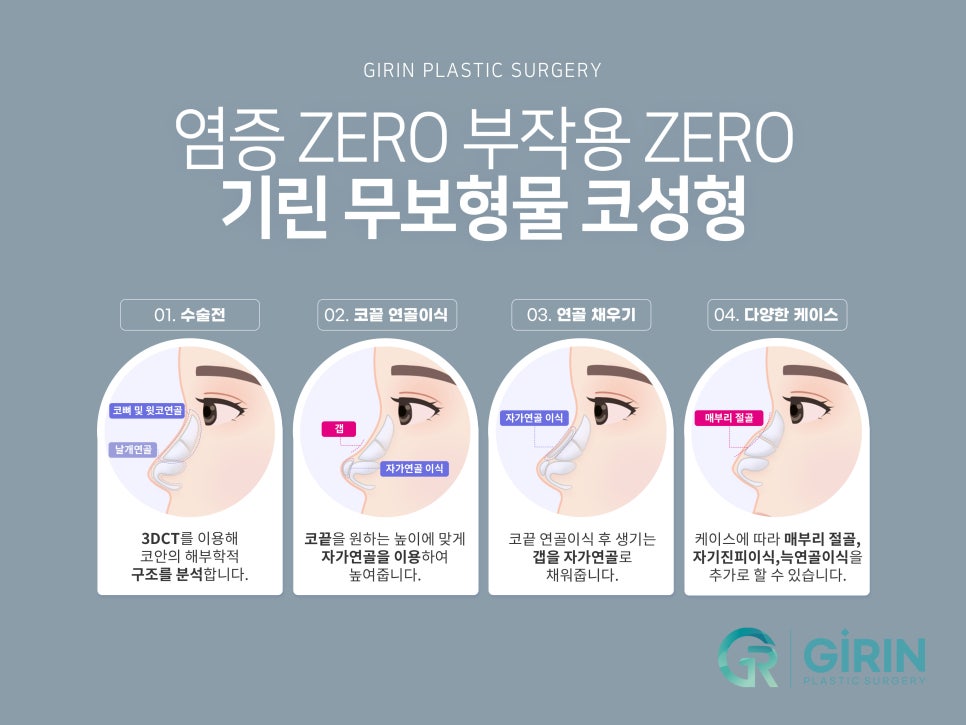 서울코성형 신중하게 정해야 관련 이미지 6