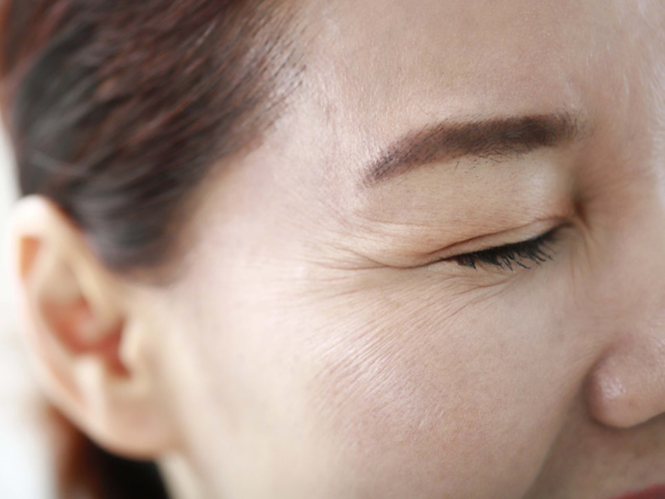 강남눈성형 눈가 주름 개선을 위해 관련 이미지 2