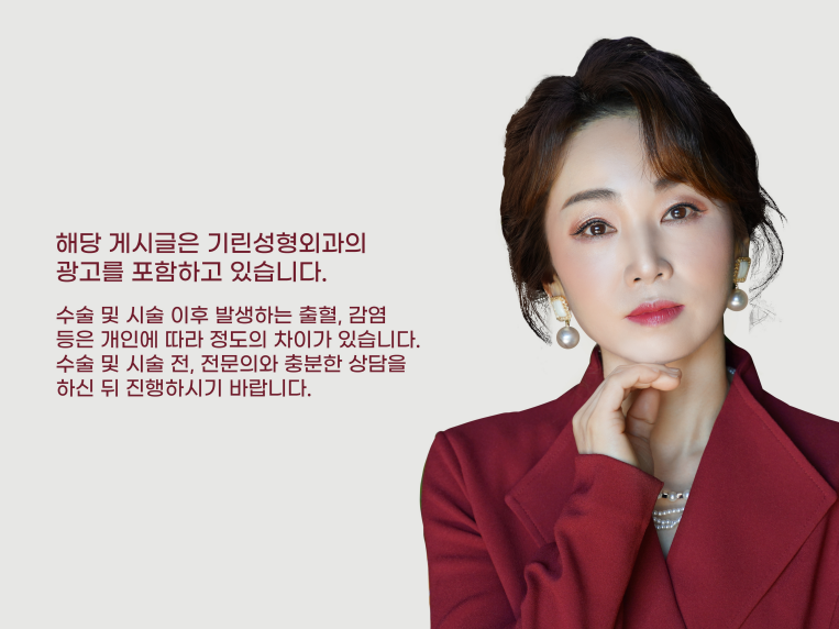 상하안검수술 인상을 바꾸기 위해 관련 이미지 18