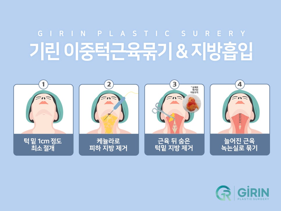 이중턱지방흡입 하나로 어렵다면? 관련 이미지 7