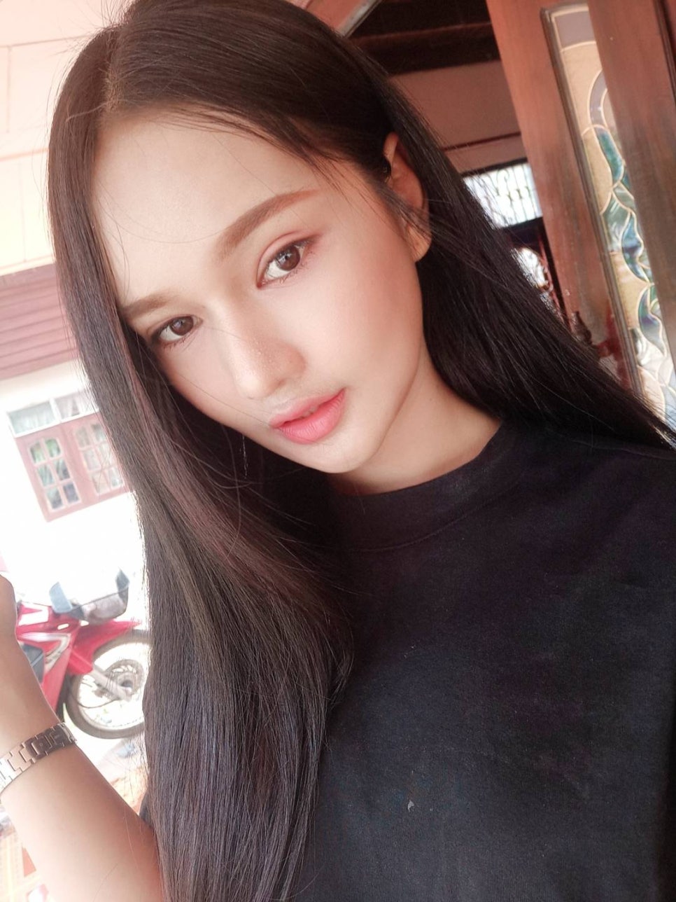 [사각턱축소 최다수술 이승룡원장] 태국에서 온 그녀의 윤곽 수술 후기 리얼 스토리&hearts; 관련 이미지 7