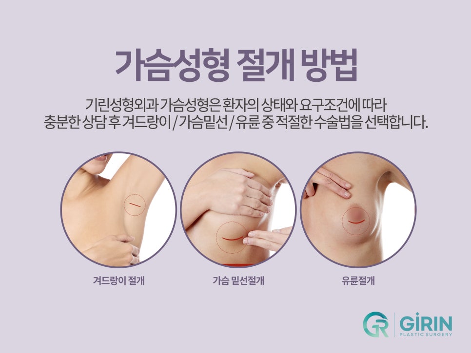 가슴거상술 변화를 기대하며 관련 이미지 5