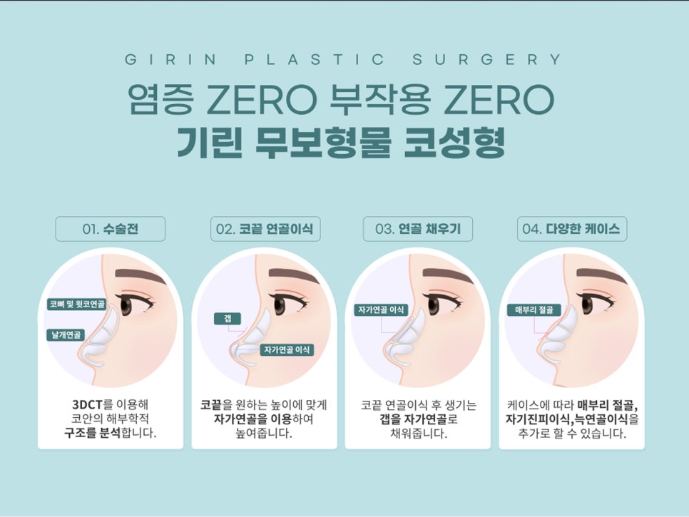 무보형물 코성형 안전하게 잘하는 곳 관련 이미지 6