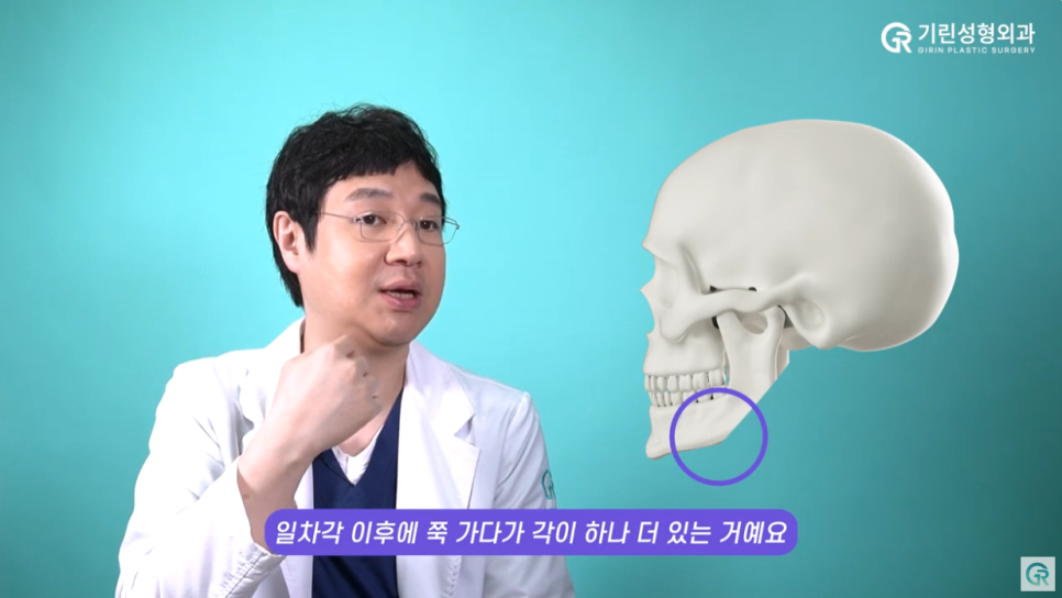 [기린성형외과의원] ❌보정어플은 당장 삭제❌_윤곽3종 수술일지 관련 이미지 5