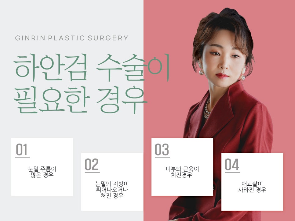 중년눈성형 우아하게 잡아주며 관련 이미지 7