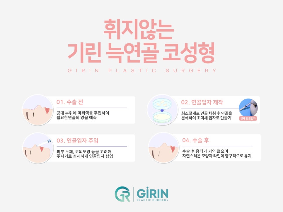 여자코수술 모양도 고려하여 관련 이미지 4