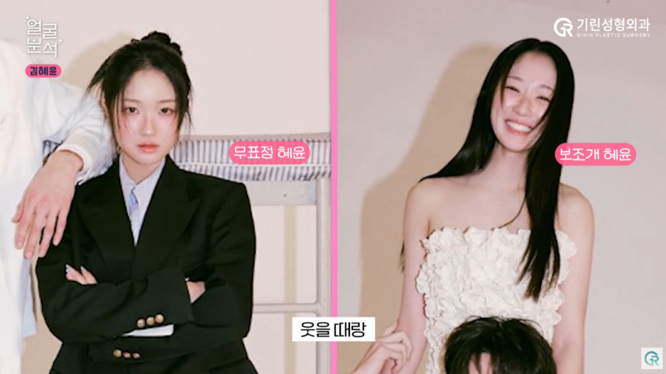[기린성형외과의원] 선재 업고 튄 임솔 비주얼_선업튀 2탄 김혜윤 얼굴분석 관련 이미지 9