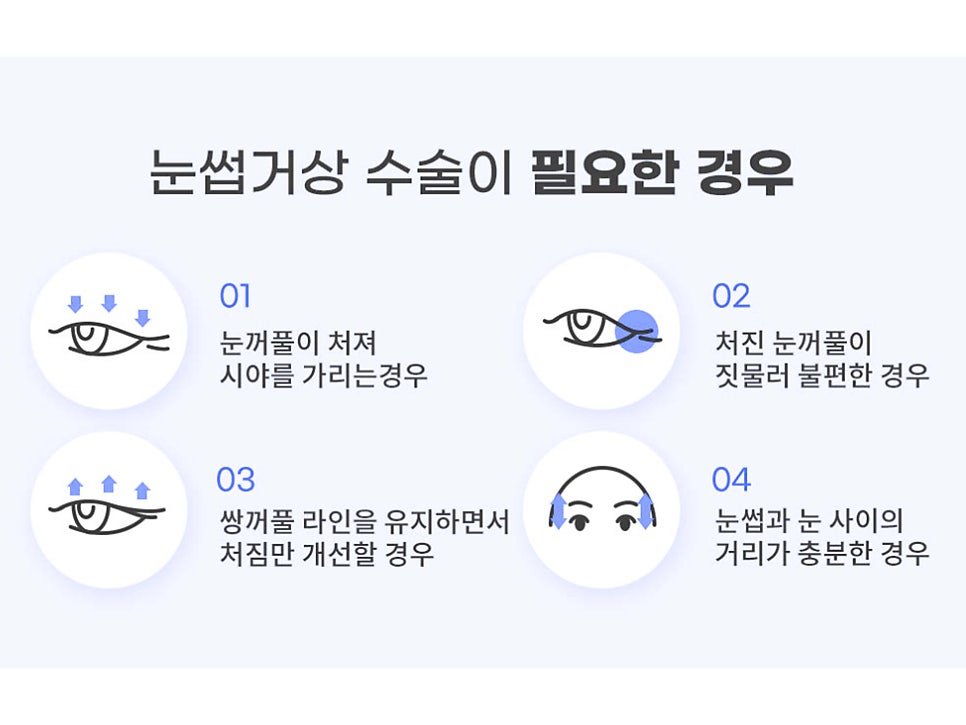 상안검수술회복기간 확인하자 관련 이미지 10