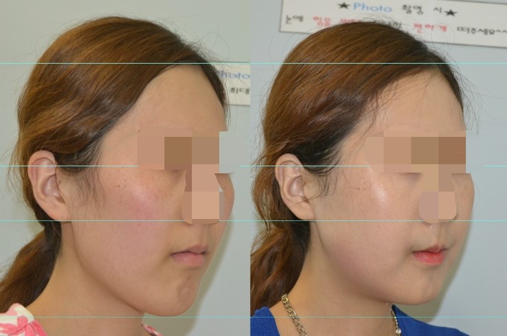 긴곡선을 통한 길이줄임 3주차 관련 이미지 3