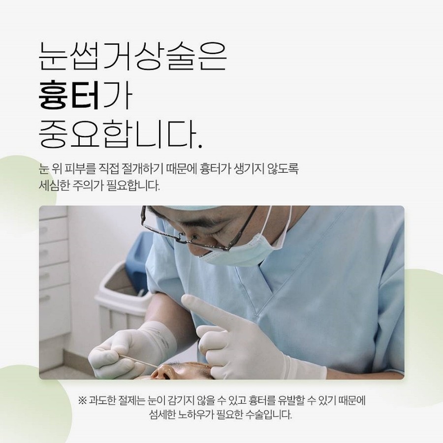 중년눈성형 처진눈수술 비절개로 가능? 관련 이미지 4