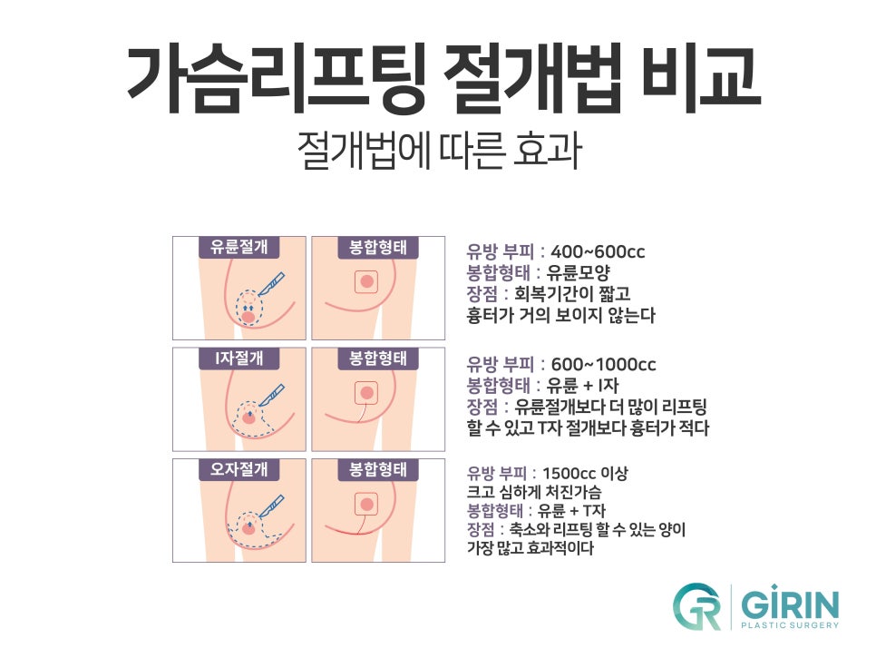 가슴거상술 흉터에 대한 걱정은 관련 이미지 4