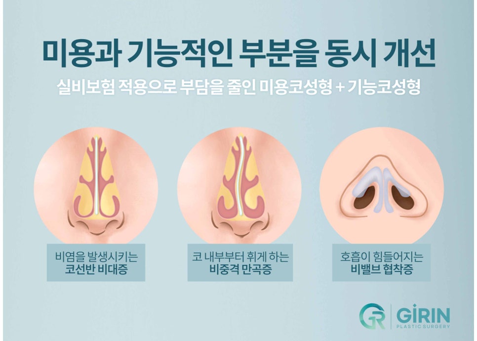 낮은코수술 눈에 보이는 차이를 원한다면 관련 이미지 14