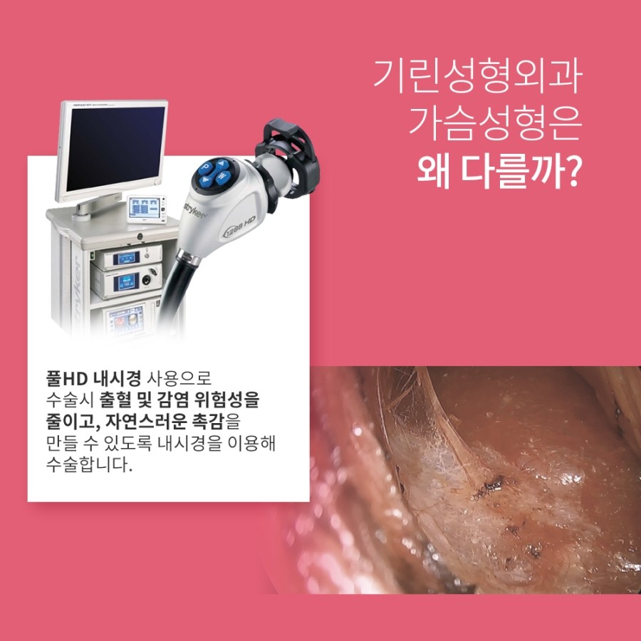유방확대수술비용 궁금하다면 여긴어때요? 관련 이미지 3