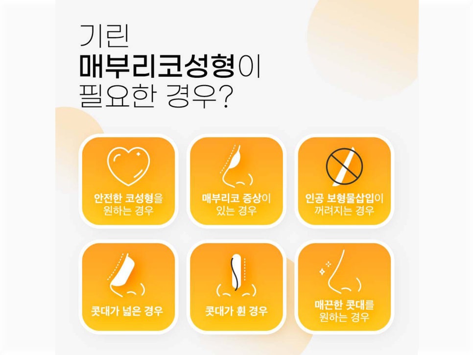 매부리코수술후기 올바른 라인으로 관련 이미지 7