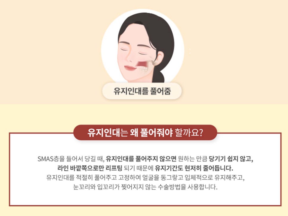 안면거상수술 효과 확실하려면 관련 이미지 11