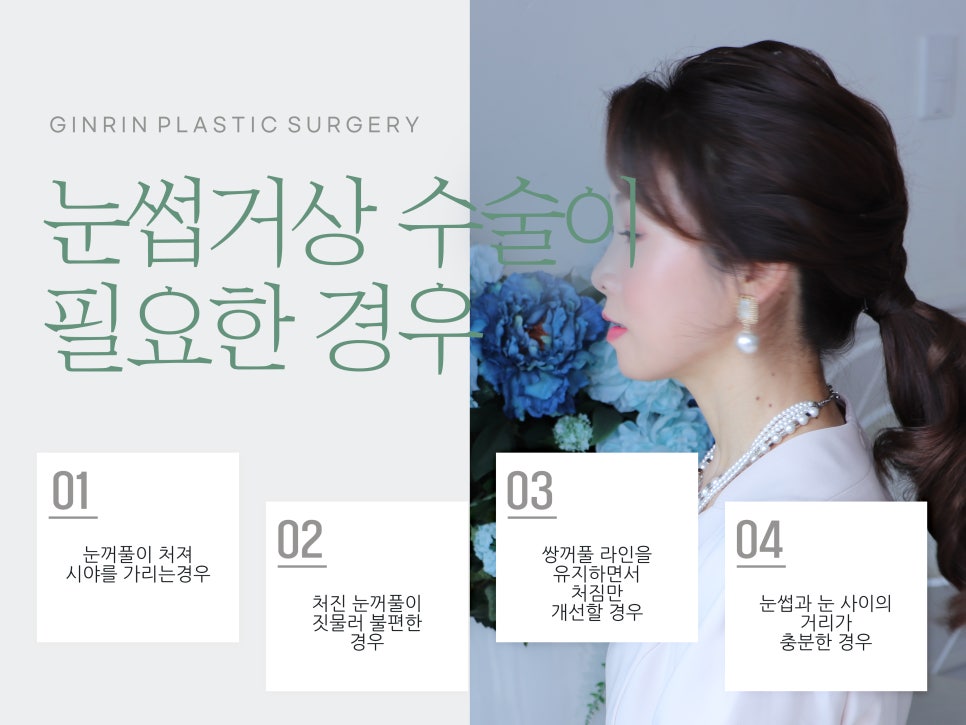 중년눈성형 우아하게 잡아주며 관련 이미지 13