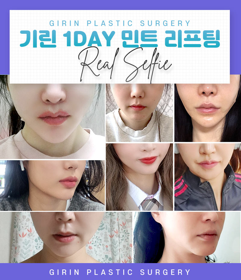 한시간의 즉각적인 효과를 원한다면 1day 민트리프팅:D 짧은줄 관련 이미지 9