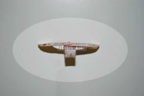 안면윤곽 볼처짐에 관한 진실 : 티절골을 하면 왜 이중턱이 생길까 관련 이미지 1