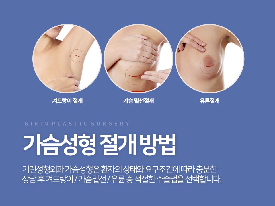 가슴확대수술 효율성 따져보며 관련 이미지 3