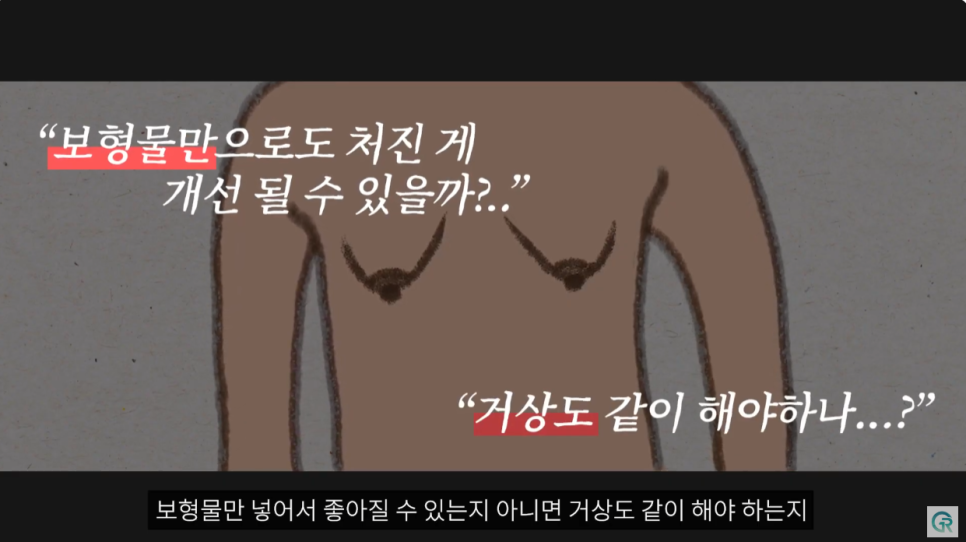 [기린성형외과의원] 다이어트 후 작고, 처진가슴 개선방법_가슴성형 수술일지 관련 이미지 9