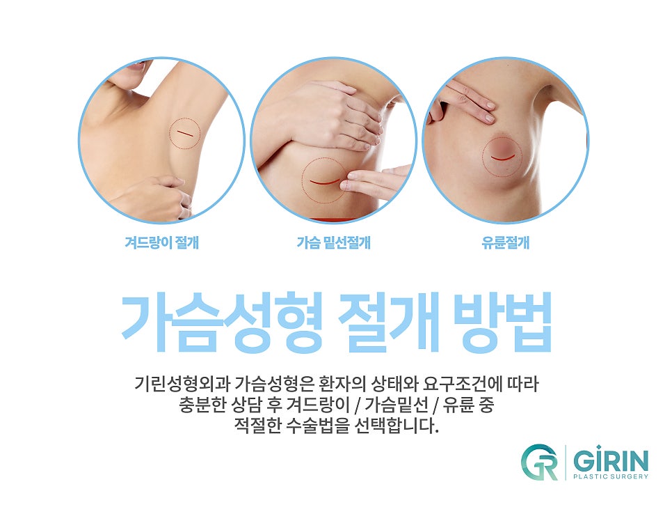 모티바가슴성형후기 신중하게 살펴보고 관련 이미지 14