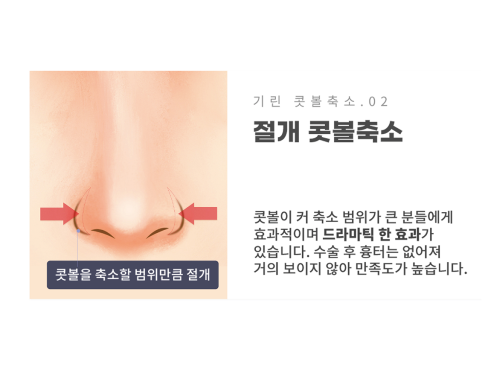 콧볼축소술 세련된 인상을 원한다면 관련 이미지 9