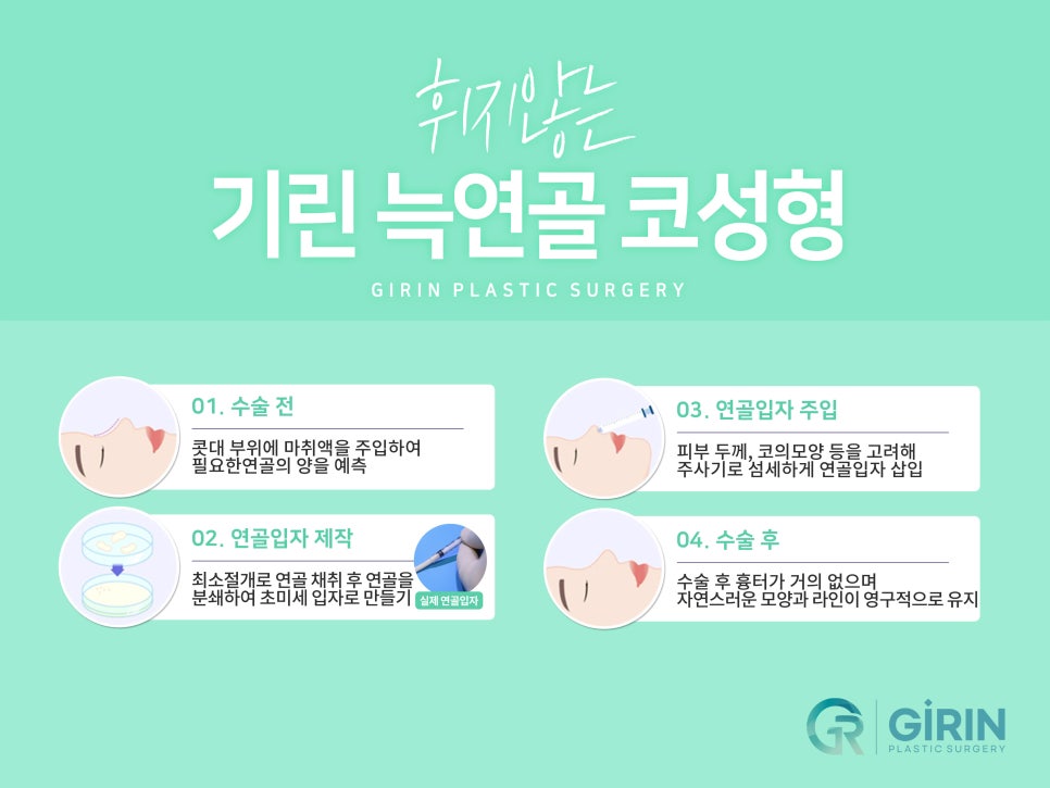 무보형물 코수술 라인을 잡아주며 관련 이미지 6