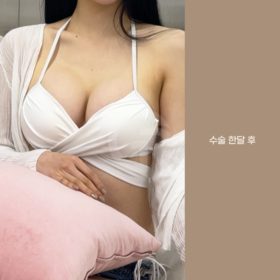 기린성형외과 가슴성형 패션 인플루언서의 고민 해결 관련 이미지 7