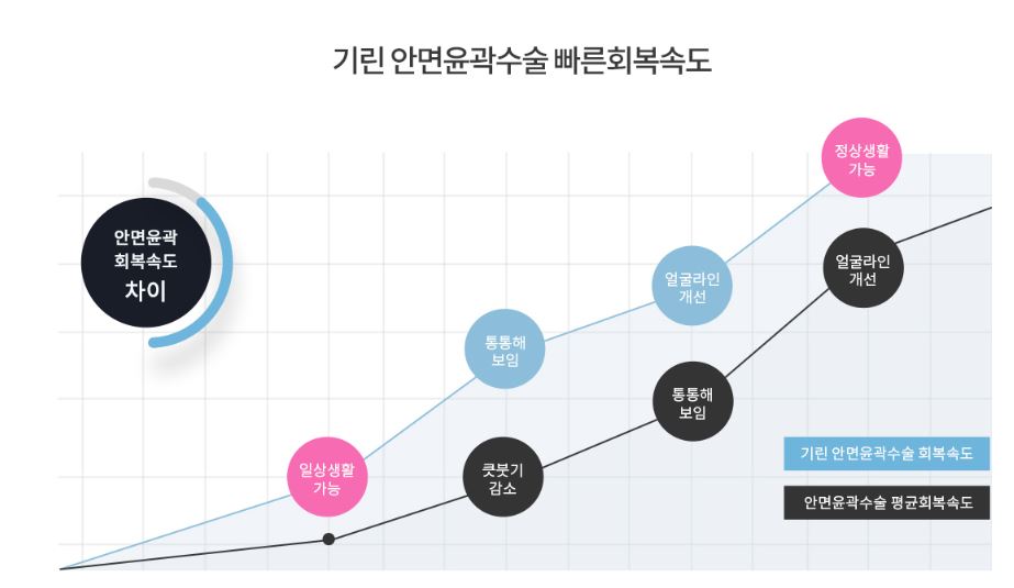 [사각턱축소 최다수술 이승룡원장] 태국에서 온 그녀의 윤곽 수술 후기 리얼 스토리&hearts; 관련 이미지 10