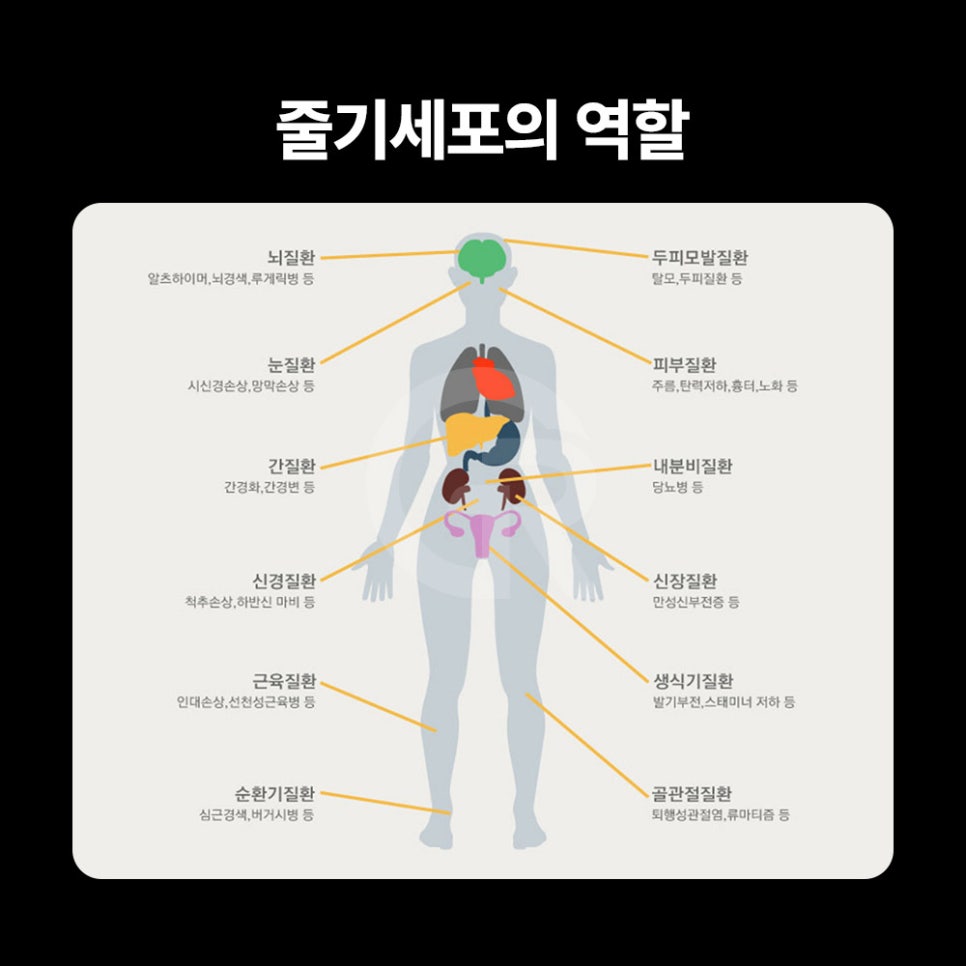 셀뱅킹, 줄기세포 전문 기린성형외과가 제안하는 미래 건강 관리 관련 이미지 4