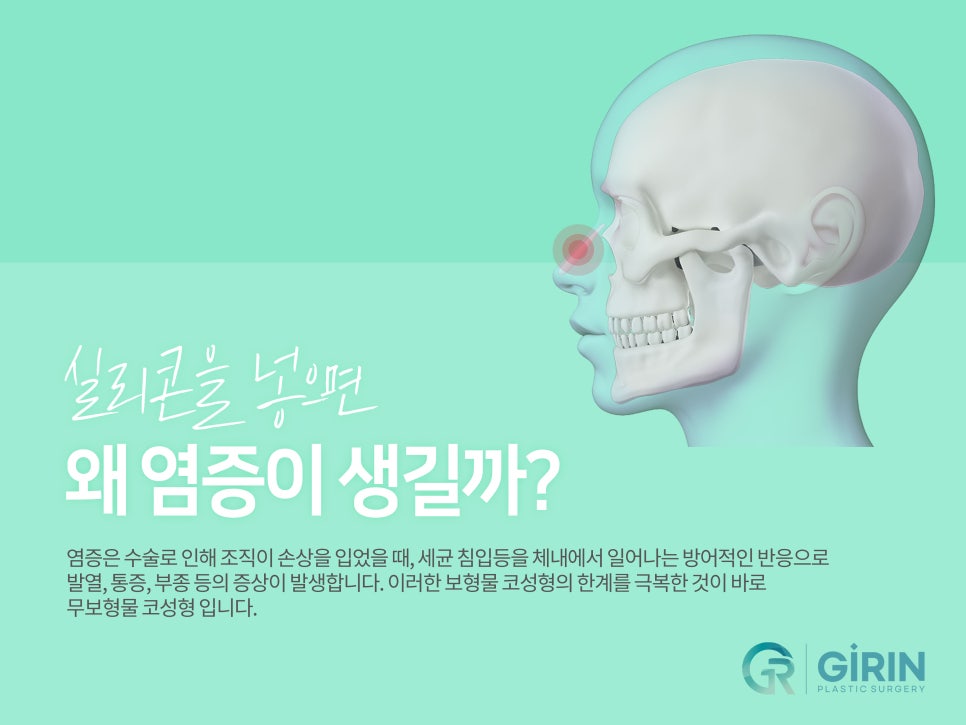 무보형물 코수술 라인을 잡아주며 관련 이미지 1