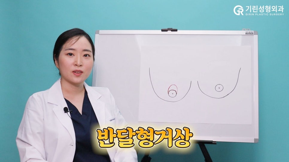 [기린성형외과]가슴거상_처진가슴 자가 진단법 및 수술법 관련 이미지 5