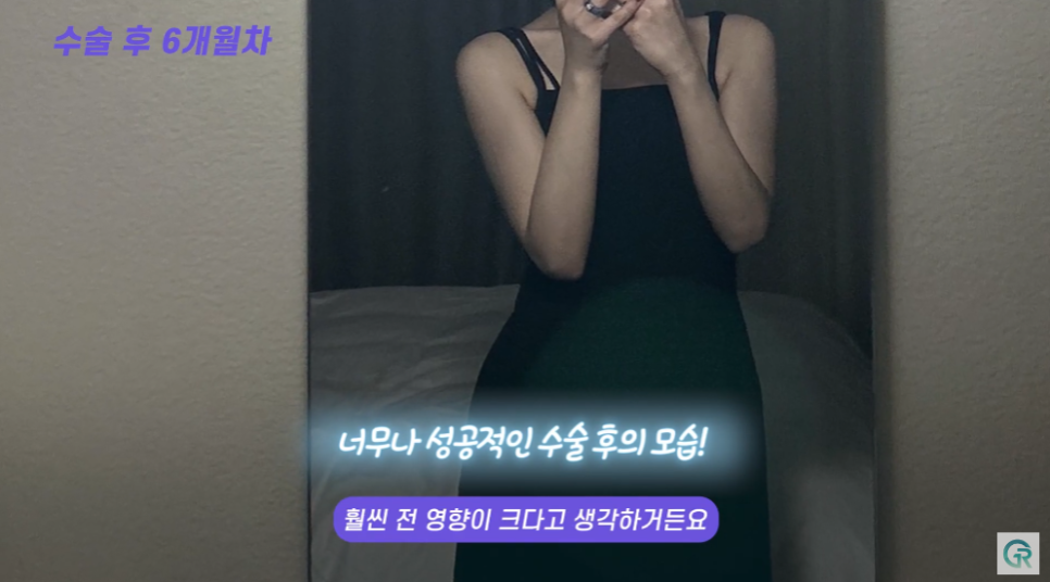 [기린성형외과] 뼈 팔뚝 된 비결 알려줄게_팔뚝 지방흡입 수술일지 관련 이미지 9