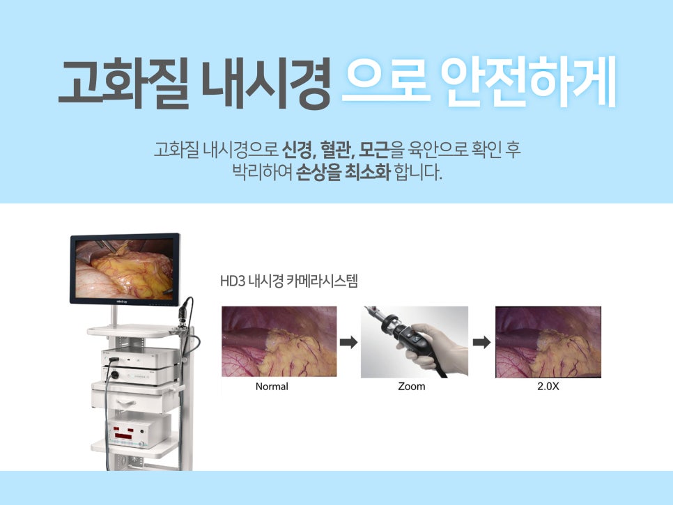 이마거상술 미리 확인해야 할 부분은? 관련 이미지 8