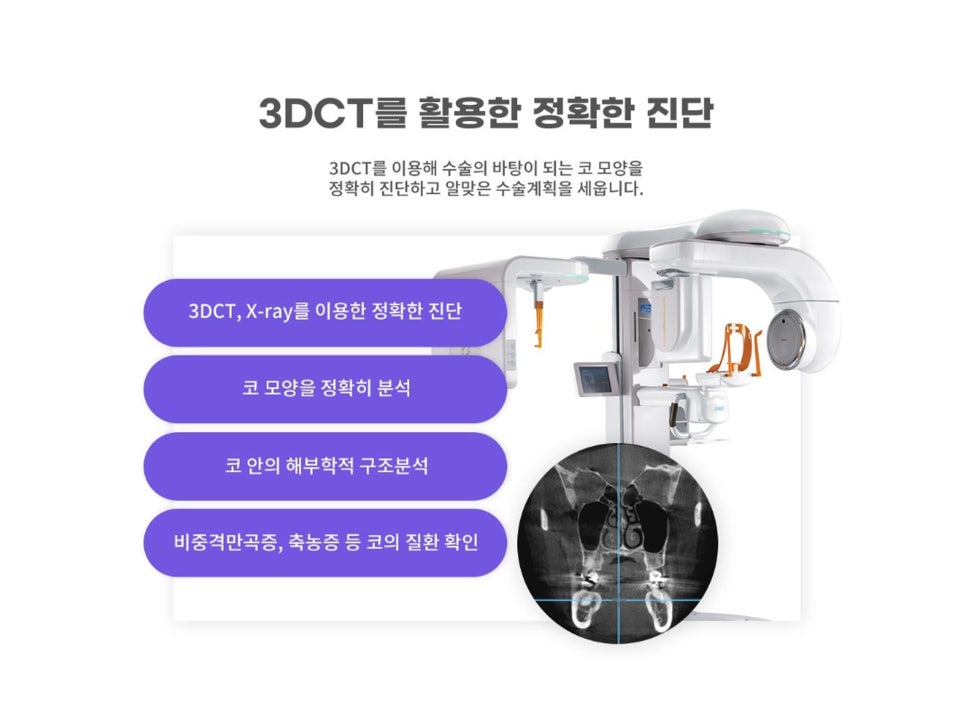 콧볼축소수술전후 얼마나 달라질까 관련 이미지 8