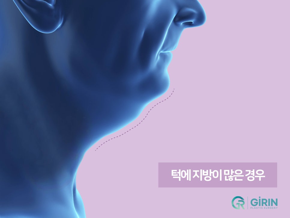 강남이중턱지방흡입 체크할 것 관련 이미지 6