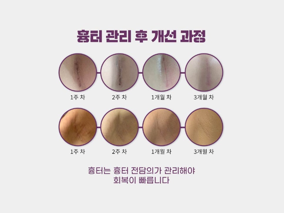 논현역 성형외과 안심할 수 있는 가슴확대수술 관련 이미지 9