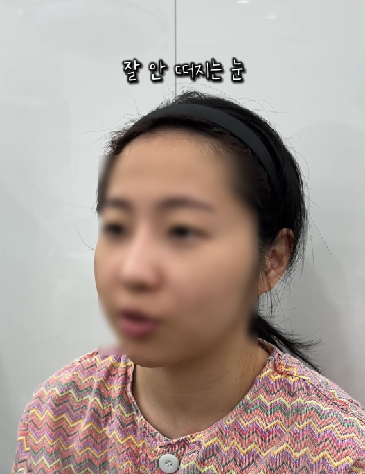 강남역 근처 쌍꺼풀 잘하는 곳 어디? 생생한 후기 관련 이미지 4