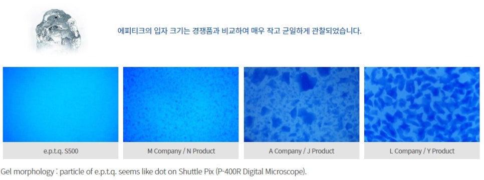 임보라가 선택한 안전한 필러, 에피티크 필러 알아보기! 관련 이미지 4