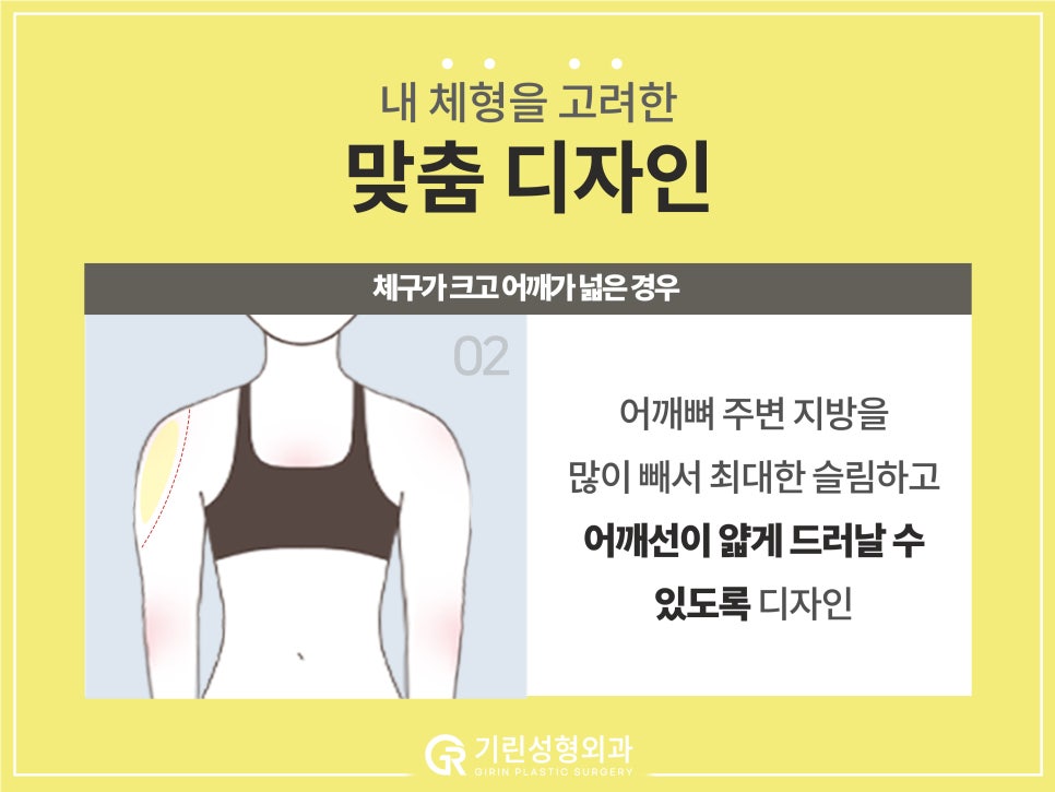 [기린 성형외과] 예쁜 라인 찾는 체형별 팔뚝지방흡입 관련 이미지 8