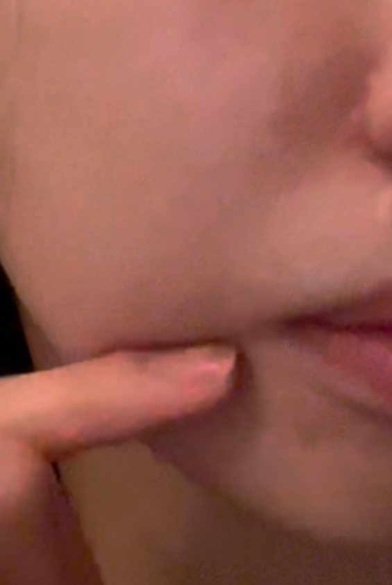 일요일에도 리프팅 가능한 이유 기린성형외과 관련 이미지 2